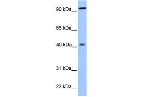 PYGO1 antibody used at 0. (PYGO1 antibody  (N-Term))