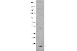 Western blot analysis of ASC2 using HepG2 whole cell lysates (PYDC1 antibody)