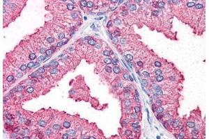 Human Prostate (formalin-fixed, paraffin-embedded) stained with DC2 antibody ABIN351430 at 10 ug/ml followed by biotinylated goat anti-rabbit IgG secondary antibody ABIN481713, alkaline phosphatase-streptavidin and chromogen. (OSTC antibody  (Internal Region))