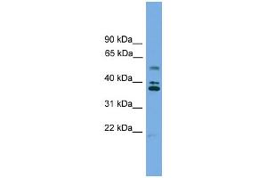 WB Suggested Anti-LDLRAD3 Antibody Titration: 0. (LDLRAD3 antibody  (Middle Region))