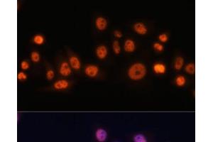 Immunofluorescence analysis of HeLa cells using EFTUD2 Polyclonal Antibody at dilution of 1:100.