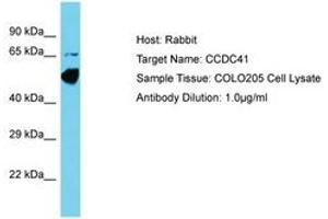 Image no. 1 for anti-Coiled-Coil Domain Containing 41 (CCDC41) (AA 148-197) antibody (ABIN6750609) (CCDC41 antibody  (AA 148-197))