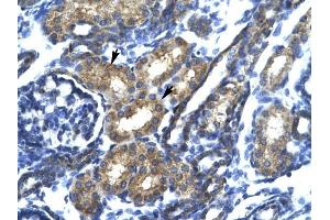 SP140 antibody was used for immunohistochemistry at a concentration of 4-8 ug/ml to stain Epithelial cells of renal tubule (arrows) in Human Kidney. (SP140 antibody  (N-Term))