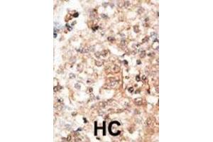 Immunohistochemistry (IHC) image for anti-Osteocalcin (BGLAP) antibody (ABIN3001265) (Osteocalcin antibody)