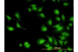 Immunofluorescence (IF) image for anti-Interleukin-1 Receptor-Associated Kinase 1 (IRAK1) (AA 530-693) antibody (ABIN614625)