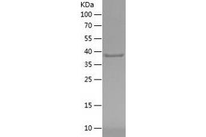 Western Blotting (WB) image for Hydrocephalus Inducing (HYDIN) (AA 2364-2511) protein (His-IF2DI Tag) (ABIN7282473) (Hydrocephalus Inducing (HYDIN) (AA 2364-2511) protein (His-IF2DI Tag))