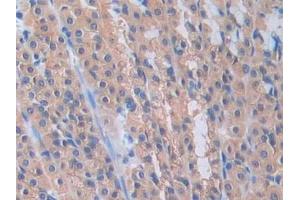 DAB staining on IHC-P; Samples: Rat Stomach Tissue (PANX1 antibody  (AA 77-260))