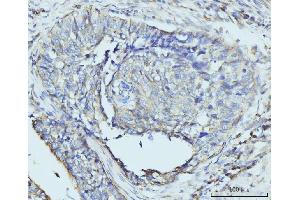 IHC analysis of RPL23 using anti-RPL23 antibody (ABIN7599808). (RPL23 antibody  (AA 12-136))