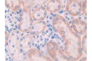 Detection of NCAD in Rat Kidney Tissue using Polyclonal Antibody to N-cadherin (NCAD)