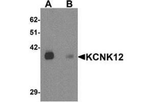 Western blot analysis of KCNK12 in rat brain tissue lysate with KCNK12 Cat.