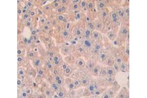Used in DAB staining on fromalin fixed paraffin- embedded Kidney tissue (BCL10 antibody  (AA 1-233))