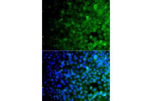 Immunofluorescence analysis of A549 cells using USP10 antibody. (USP10 antibody)