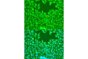 Immunofluorescence analysis of U2OS cells using TAZ antibody (ABIN7271395) at dilution of 1:100. (WWTR1 antibody  (C-Term))