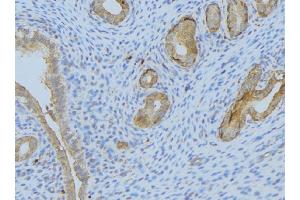ABIN6275296 at 1/100 staining Human uterus tissue by IHC-P. (Neurexophilin 1 antibody  (Internal Region))
