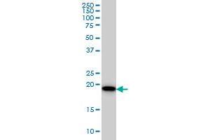 SRI monoclonal antibody (M01), clone 1E12 Western Blot analysis of SRI expression in HeLa . (SRI antibody  (AA 1-198))
