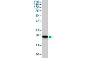 SRI antibody  (AA 1-198)