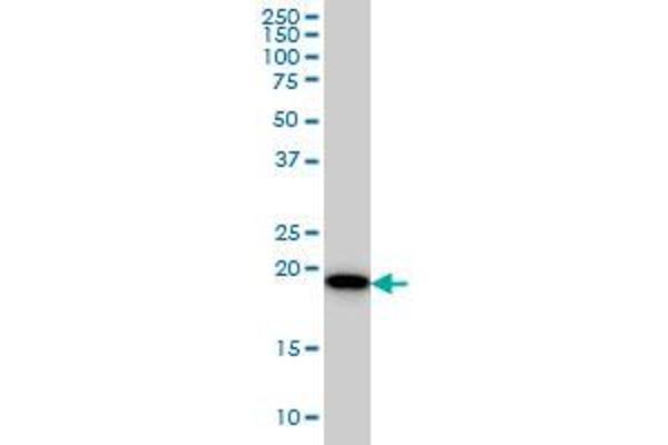 SRI antibody  (AA 1-198)