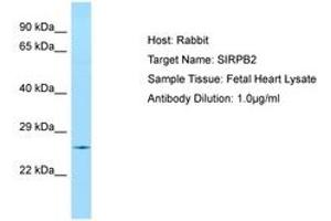 Image no. 1 for anti-Signal-Regulatory Protein beta 2 (SIRPb2) (AA 110-159) antibody (ABIN6750071) (SIRPb2 antibody  (AA 110-159))
