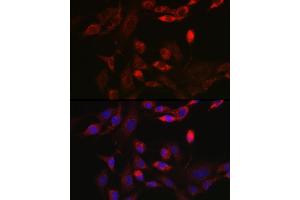 Immunofluorescence analysis of NIH/3T3 cells using BNIP3L Rabbit pAb (ABIN6129989, ABIN6137622, ABIN6137623 and ABIN6221881) at dilution of 1:100 (40x lens). (BNIP3L/NIX antibody  (AA 1-187))
