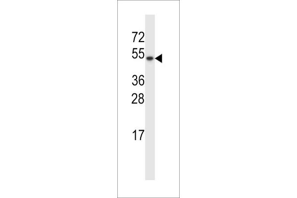 TXNDC15 antibody  (C-Term)