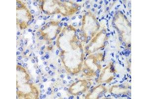 Immunohistochemistry of paraffin-embedded Mouse kidney using HCLS1 Polyclonal Antibody at dilution of 1:100 (40x lens). (HCLS1 antibody)