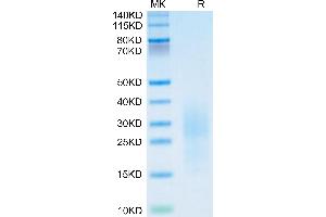 PSCA Protein (AA 21-95) (His tag)