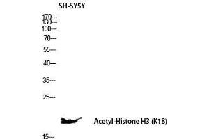 Western Blot (WB) analysis of SH-SY5Y lysis using Acetyl-Histone H3 (K18) antibody. (Histone 3 antibody  (H3K18ac))