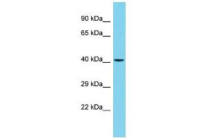 Host: Rabbit Target Name: WBSCR16 Sample Type: Hela Whole Cell lysates Antibody Dilution: 1. (WBSCR16 antibody  (N-Term))
