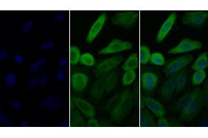 Detection of HSP90aA1 in Human HepG2 cell using Polyclonal Antibody to Heat Shock Protein 90 kDa Alpha A1 (HSP90aA1) (HSP90AA1 antibody  (AA 698-732))