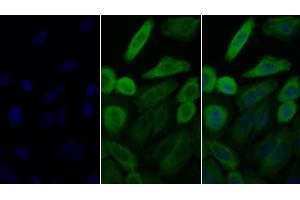 Detection of HSP90aA1 in Human HepG2 cell using Polyclonal Antibody to Heat Shock Protein 90 kDa Alpha A1 (HSP90aA1) (HSP90AA1 antibody  (AA 698-732))