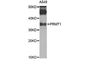 Western blot analysis of extracts of A-549 cells, using PRMT1 antibody (ABIN1874325) at 1:1000 dilution. (PRMT1 antibody)