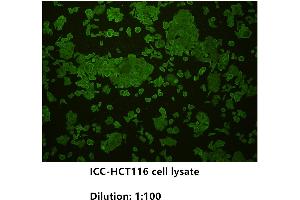 Immunocytochemistry (ICC) image for anti-Cadherin 1, Type 1, E-Cadherin (Epithelial) (CDH1) (Extracellular) antibody (ABIN1854887) (E-cadherin antibody  (Extracellular))
