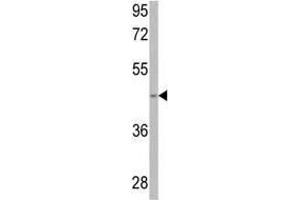 Western blot analysis of anti-SPHK1 Antibody (Center) in 293 cell line lysates (35 µg/lane). (SPHK1 antibody  (AA 286-315))