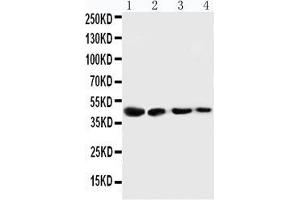 Anti-Cystathionase antibody, Western blotting Lane 1: SMMC Cell Lysate Lane 2: HT180 Cell Lysate Lane 3: HELA Cell Lysate Lane 4: U87 Cell Lysate (CTH antibody  (C-Term))