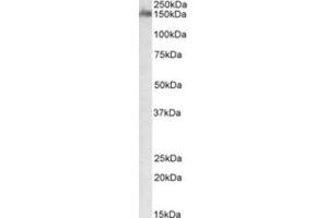 Western Blotting (WB) image for anti-CUB and Sushi Multiple Domains 1 (CSMD1) (Internal Region) antibody (ABIN2464386)