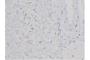 ABIN6267463 at 1/200 staining Human esophagus tissue sections by IHC-P. (CDC25A antibody  (pSer75))