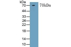 Detection of Recombinant TNNT2, Human using Monoclonal Antibody to Troponin T Type 2, Cardiac (TNNT2) (Cardiac Troponin T2 antibody  (AA 1-295))