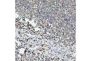Immunohistochemical analysis of Beta-tubulin staining in human tonsil formalin fixed paraffin embedded tissue section. (TUBB antibody)