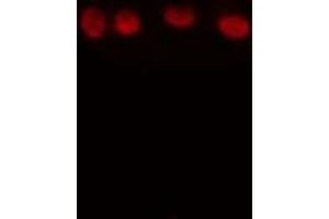 ABIN6274245 staining HuvEc cells by IF/ICC. (TCF7 antibody)