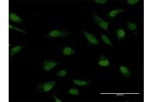 Immunofluorescence of purified MaxPab antibody to CRY1 on HeLa cell. (CRY1 antibody  (AA 1-586))