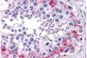 Human Testis: Formalin-Fixed, Paraffin-Embedded (FFPE) (CCDC98 antibody  (AA 1-313))