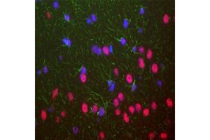 ABIN1580460 was used to stain a section of formalin fixed adult rat brain, specifically the hippocampus. (TARDBP antibody)