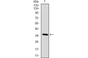 Western blot analysis using MAP2 antibody against human MAP2 recombinant protein. (MAP2 antibody  (AA 24-123))