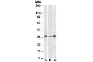 Western blot testing of human [A], mouse [B] and rat [C] brain lysate with EB3 antibody at 0. (MAPRE3 antibody)