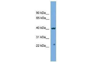 Western Blot showing CENPN antibody used at a concentration of 1-2 ug/ml to detect its target protein. (CENPN antibody  (Middle Region))