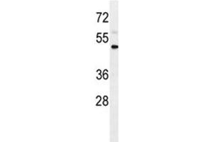 IL1R2 antibody western blot analysis in WiDr lysate. (IL1R2 antibody  (AA 273-300))