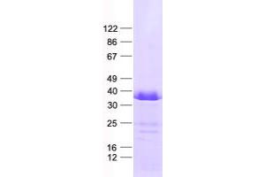 Validation with Western Blot (CCRK Protein (His tag))