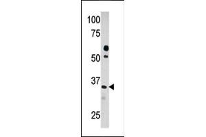 Western blot analysis of anti-PDXK (ABIN391248 and ABIN2841310) in HepG2 cell line lysate (35 μg/lane). (PDXK antibody  (C-Term))