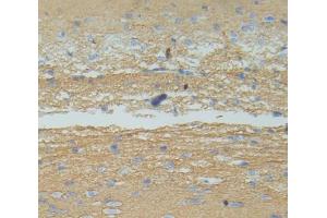 IHC-P analysis of Rat Tissue, with DAB staining. (IL12B antibody  (AA 30-311))