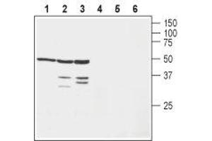 Western blot analysis of human SH-SY5Y neuroblastoma cell lysate (lanes 1 and 4), mouse brain lysate (lanes 2 and 5) and rat brain lysate (lanes 3 and 6): - 1-3. (KCNAB1 antibody  (N-Term))